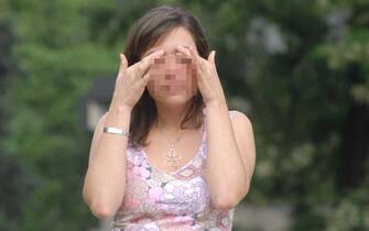 Una donna allergica
