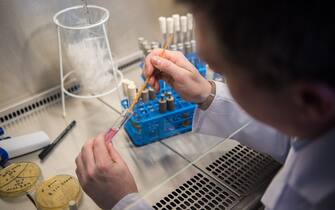 The head of the national reference centre for invasive fungal infections, Oliver Kurzai, putting a sample of a yeast fungus into a test tube with a colour indicator at a laboratory of the University of Wuerzburg in Wuerzburg, Germany, 23 January 2018. In Germany, an the number of patients suffering from the dangerous yeast infection Candida auris is rising. Photo: Nicolas Armer/dpa (Photo by Nicolas Armer/picture alliance via Getty Images)