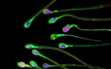 20080131 - ROMA - SCI - STAMINALI:CREATA RISERVA CELLULE GERMINALI DA EMBRIONI UMANI -  Alcuni spermatozoi in una foto d'archivio.  Una riserva di cellule 'germinali', cioe' quelle riproduttive capostipiti di ovociti e spermatozoi, e' stata creata a partire da cellule embrionali umane.     Reso noto sulla rivista Nature, il traguardo ha permesso di decodificare i geni piu' importanti che regolano nell'embrione le tappe di formazione delle cellule germinali e, quindi, potrebbe aprire la strada alla comprensione di molti casi di sterilita'. ANSA/dba