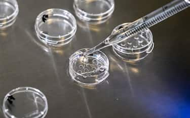 PRODUCTION - 17 January 2024, Berlin: In the cell laboratory, culture dishes are prepared at the Fertility Center Berlin to collect the eggs after egg retrieval. Photo: Jens Kalaene/dpa (Photo by Jens Kalaene/picture alliance via Getty Images)