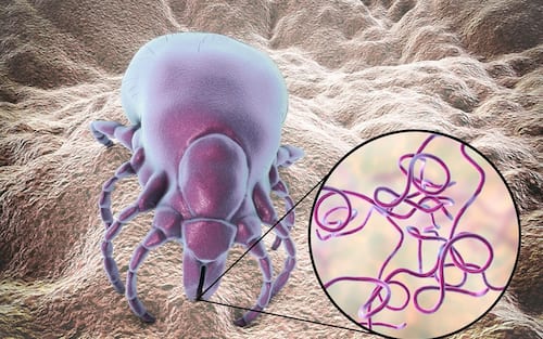 Lyme disease tick, illustration. Ticks (superfamily Ixodoidea) are external parasites that feed on human and animal blood. Their bite can transmit a number of diseases including Lyme disease, which is caused by the bacterium Borrelia burgdorferi.