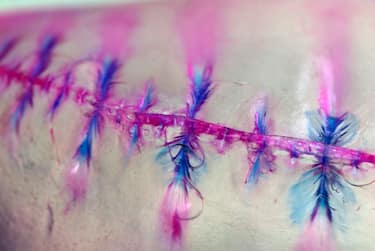 I rischi per l’uomo