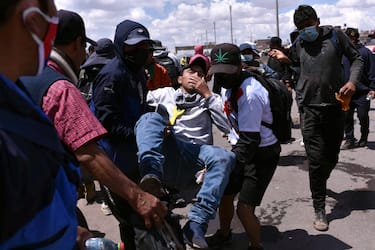 epa10397382 A man injured in clashes between protesters and security forces is taken to be treated, in Juliaca, Peru, 09 January 2023. 12 people died in Juliaca on 09 January, bringing the total to 41 deaths since the start of protests demanding the resignation of the President Dina Boluarte and calling for a constituent assembly.  EPA/Stringer