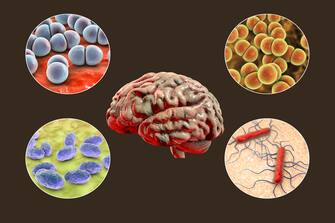 Causes of bacterial meningitis, computer illustration. Neisseria meningitidis, Streptococcus pneumoniae, Haemophilus influenzae and Listeria monocytogenes bacteria, the main causative agents of bacterial meningitis.