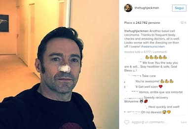 Hugh Jackman, operato ancora: cancro al naso per "Wolverine"