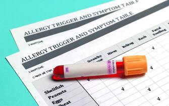 Blood sample lying on allergy test sheets