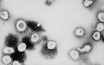ATLANTA, GA - UNDATED:  This undated handout photo from the Centers for Disease Control and Prevention (CDC) shows a microscopic view of the Coronavirus at the CDC in Atlanta, Georgia. According to the CDC the virus that causes Severe Acute Respiratory Syndrome (SARS) might be a "previously unrecognized virus from the Coronavirus family."  (Photo by CDC/Getty Images)  