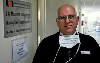 Oncologist Paolo Ascierto who, in light of the progress made by patients being treated for Coronavirus, has called for a national protocol to extend the use of tocilizumab, anti-arthritis drug, in infected patients and in conditions Critical, Naples, Italy, 11 March 2020.  ANSA / Ciro Fusco