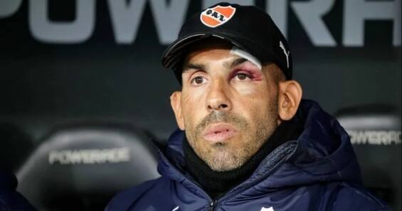 Tevez, enfermo en casa: el técnico ya está en el banquillo tras el accidente