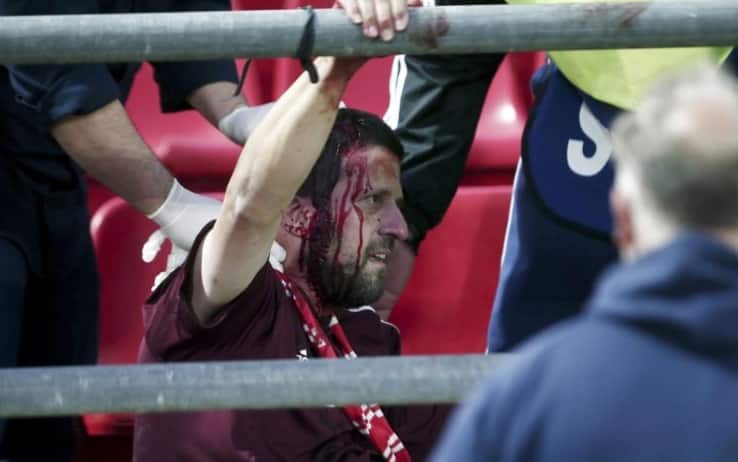 Youth League: 4 tifosi tedeschi feriti da hooligans greci