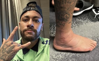La caviglia di Neymar fa impressione. Ma lui...