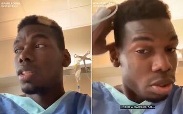 Pogba dopo l'operazione: "Cerco un parrucchiere"