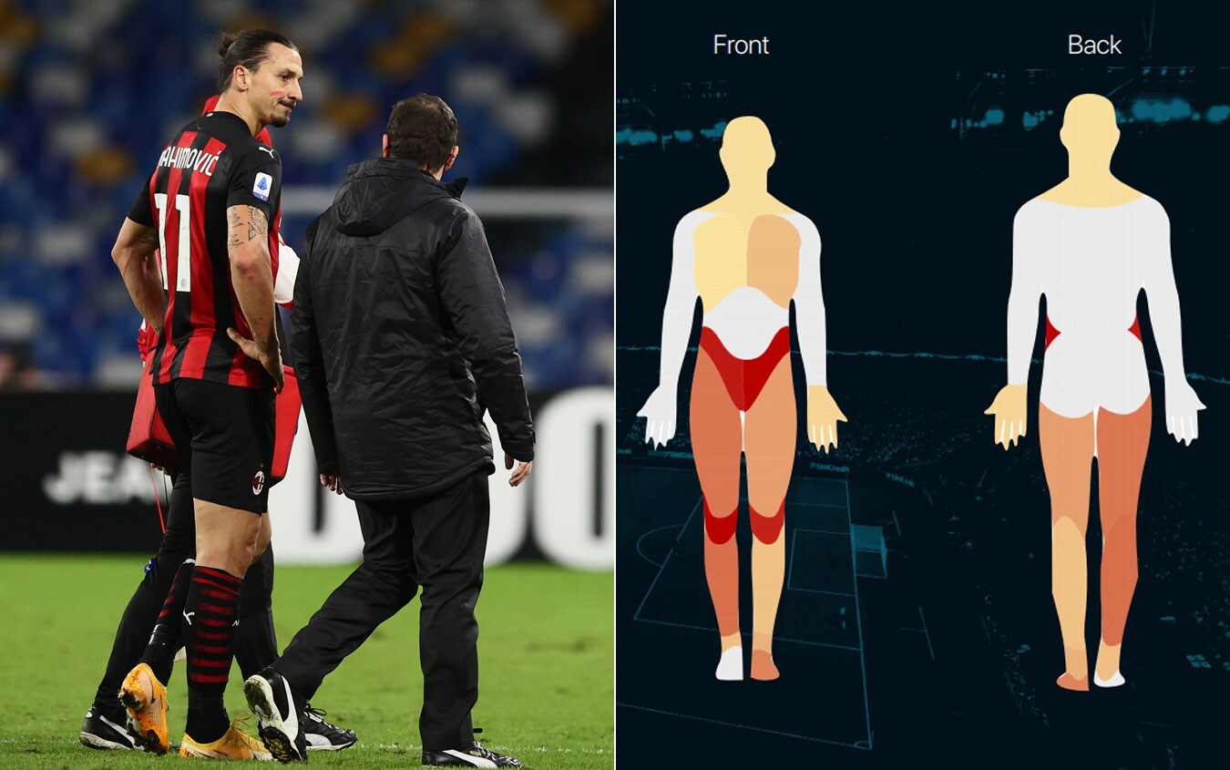 La "mappa" degli infortuni di Ibrahimovic elaborata da "Injuries Noisefeed" Ibrahimovic infortuni