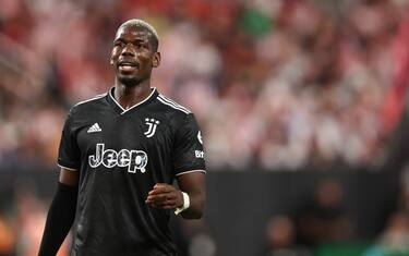 Pogba si dovrà operare: starà fermo almeno 1 mese