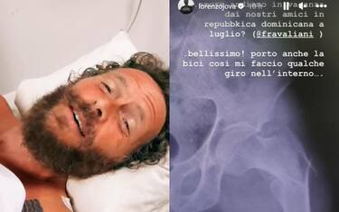 Jovanotti cade in bici: "Rotto clavicola e femore"