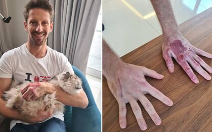 Grosjean mostra le mani senza bende. FOTO