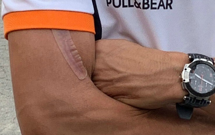 Marquez