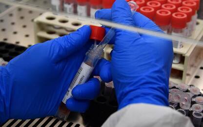 Coronavirus: Marche, cinque positivi su 567 nuove diagnosi