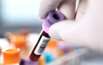 Researcher taking blood sample from a rack of medical samples.