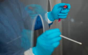 A health worker prepares to collect a swab sample to test a patient for COVID-19 in Nezahualcoyotl, Mexico state on July 13, 2020 amid the coronavirus pandemic. - Mexico became on Sunday the fourth country with the most deaths in the world from the new coronavirus after overtaking Italy, according to an AFP report based on government sources. (Photo by PEDRO PARDO / AFP) (Photo by PEDRO PARDO/AFP via Getty Images)