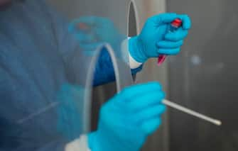 A health worker prepares to collect a swab sample to test a patient for COVID-19 in Nezahualcoyotl, Mexico state on July 13, 2020 amid the coronavirus pandemic. - Mexico became on Sunday the fourth country with the most deaths in the world from the new coronavirus after overtaking Italy, according to an AFP report based on government sources. (Photo by PEDRO PARDO / AFP) (Photo by PEDRO PARDO/AFP via Getty Images)