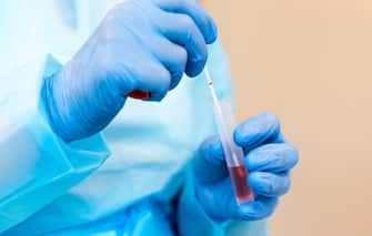 ZURICH, SWITZERLAND - JULY 15: An employee takes a throat swab sample to test for Covid-19 at the COVID-19 Test Center at the University of Zurich during the coronavirus pandemic on July 15, 2020 in Zurich, Switzerland. Switzerland has largely lifted most of its coronavirus lockdown measures and has so far registered approximately 33,000 infections. (Photo by Christian Ender/Getty Images).