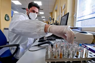 Operators at work with test tubes and tests for Covid -19 in the laboratory of the clinical biochemistry and microbiology department of the Colli Hospital in Naples, which includes Monaldi and Cotugno, 16 February 2021
 ANSA / CIRO FUSCO
