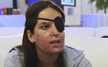 Gessica Notaro, la Cassazione: "No a sconti per chi sfregia con acido"