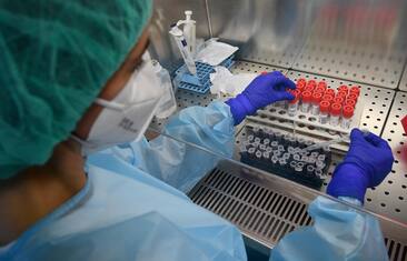 Covid, versione della variante Omicron invisibile al test molecolare