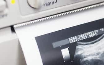 Printout of ultrasound recording (showing abdominal area) (Photo by Universal Images Group via Getty Images)