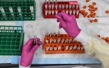 A lab technician sorts blood samples for COVID-19 vaccination study at the Research Centers of America in Hollywood, Florida on August 13, 2020. (Photo by CHANDAN KHANNA / AFP) (Photo by CHANDAN KHANNA/AFP via Getty Images)