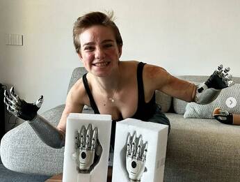 Bebe Vio svela le nuove mani bioniche su Instagram 