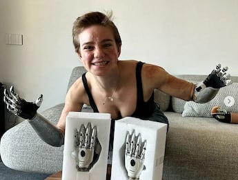 Bebe Vio svela le nuove mani bioniche su Instagram 
