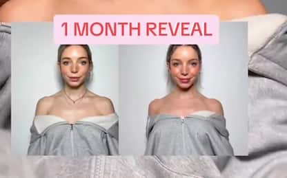 Barbie Botox, cos’è l’ultima ossessione beauty virale su TikTok