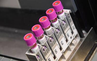 Covid Campania, 2.374 casi: tasso di positività al 12,09 per cento