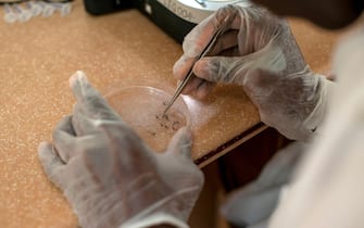 A worker of the Entomologist Research Centre takes a mosquito to analyse it for the presence of malaria parasite in Obuasi, Ashanti Region, on May 1, 2018. - The centre is set to control and prevent malaria through the analysis of parasites, mosquito monitoring and efficacy testing of insecticides. (Photo by CRISTINA ALDEHUELA / AFP)        (Photo credit should read CRISTINA ALDEHUELA/AFP via Getty Images)