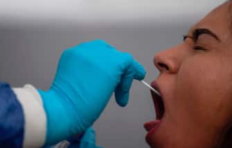 A health worker collects a swab sample from a man to get him tested for COVID-19 in Nezahualcoyotl, Mexico state on July 13, 2020 amid the coronavirus pandemic. - Mexico became on Sunday the fourth country with the most deaths in the world from the new coronavirus after overtaking Italy, according to an AFP report based on government sources. (Photo by PEDRO PARDO / AFP) (Photo by PEDRO PARDO/AFP via Getty Images)