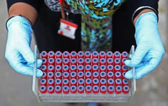 epa08799998 A health official carries blood sample tubes at the blood donation camp in Bangalore, India According to reports, India's blood shortage and public blood donations drive have dramatically reduced due to the implementation of social distancing due to fears of coronavirus covid-19 infection from public places such as hospitals and blood banks.  EPA/JAGADEESH NV