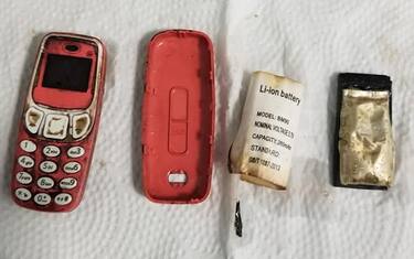 Ingoia un Nokia 3310, salvato da una equipe di medici