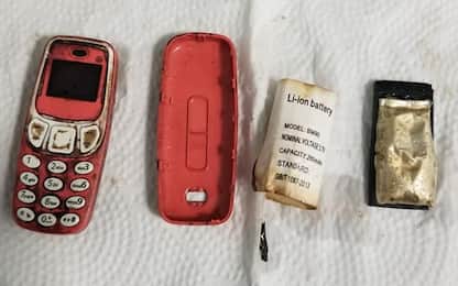 Ingoia un Nokia 3310, salvato da una equipe di medici