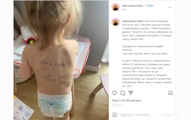 Il post della donna che ha scritto i contatti sulla schiena della figlia
