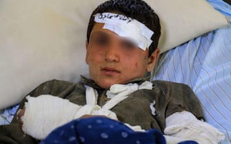epa10027420 An injured victim of the earthquake receives treatment at a hospital in Paktia, Afghanistan, 22 June 2022. More than 1,000 people were killed and over 1,500 others injured after a 5.9 magnitude earthquake hit eastern Afghanistan before dawn on 22 June, Afghanistan's state-run Bakhtar News Agency reported. According to authorities the death toll is likely to rise.  EPA/STRINGER -- BEST QUALITY AVAILABLE --