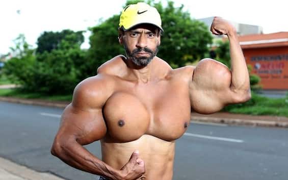 Brazilian bodybuilder Valdir Segato died, injecting oil into his muscles to swell them