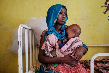 A woman holds a malnourished child at the nutrition unit of the Kelafo Health Center in the town of Kelafo, 120 kilometers from the city of Gode, Ethiopia, on April 7, 2022. - A lack of contraception and birth spacing, exclusive breastfeeding, as well as poor hygienic conditions explain the chronic undernourishment of children. The situation has been greatly aggravated by the drought and every month, the number of malnourished children increases.
The worst drought to hit the Horn of Africa for 40 years is pushing 20 million people towards starvation, according to the UN, destroying an age-old way of life and leaving many children suffering from severe malnutrition as it rips families apart. (Photo by EDUARDO SOTERAS / AFP) (Photo by EDUARDO SOTERAS/AFP via Getty Images)