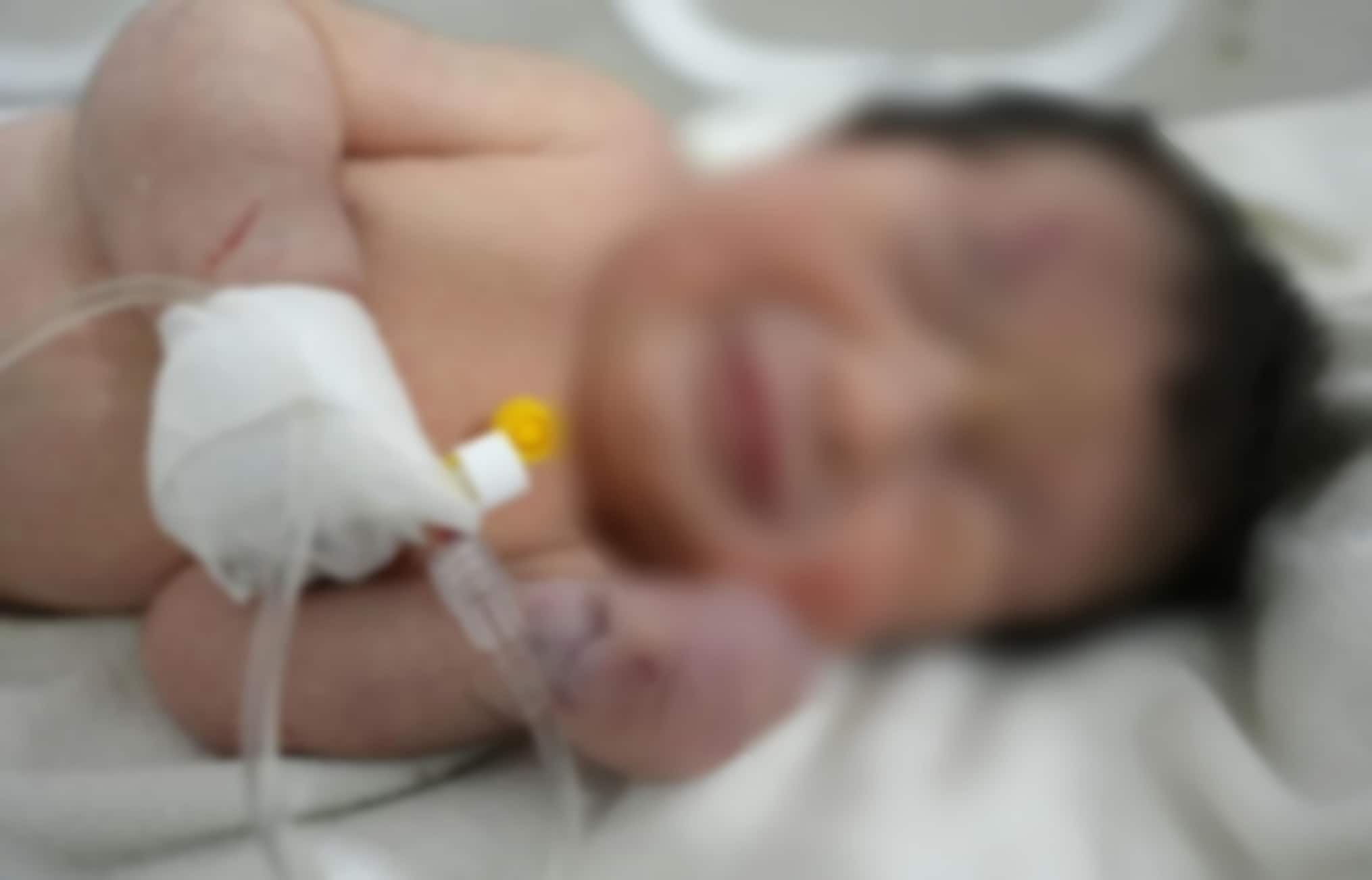 La neonata salvata in Siria