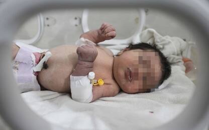 Aya, adottata la bimba nata sotto le macerie del terremoto in Siria 