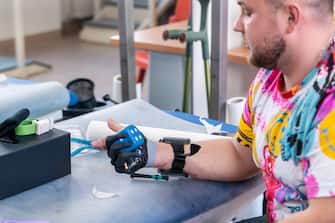 +++ EMBARGO AL 6 GIUGNO 2023 +++ Roman, soldato ucraino, prova la protesi alla mano. Tre soldati ucraini e un civile rimasto ferito in un'esplosione ricevono protesi bioniche grazie al progetto in collaborazione tra Officina Ortopedica Maria Adelaide di Torino e Superhumans Center di Leopoli, 5 giugno 2023./// Roman, a Ukrainian soldier, tries out his prosthetic hand, in Turin, Italy, 05 June 2023. Three Ukrainian soldiers and a civilian injured in an explosion receive bionic prostheses thanks to the collaborative project between the Maria Adelaide Orthopedic Workshop of Turin and the Superhumans Center of Lviv, 5 June 2023 ANSA/JESSICA PASQUALON