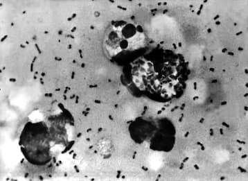 Usa, caso di peste bubbonica: uomo probabilmente infettato da un gatto