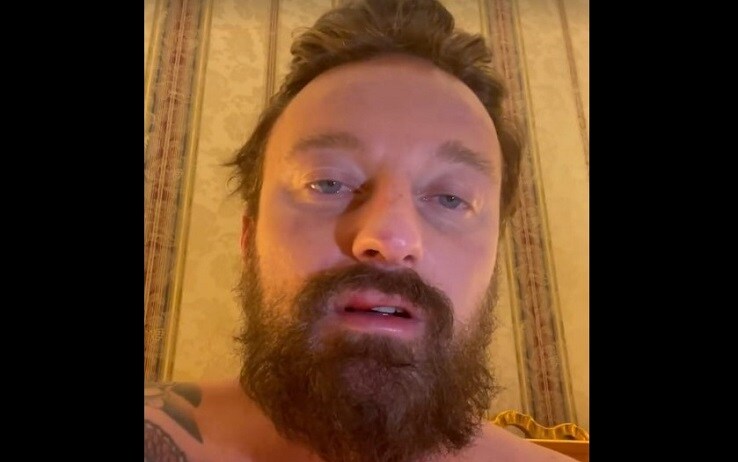 Francesco Facchinetti racconta su Instagram l'aggressione subita dal lottatore irlandese Conor McGregor Francesco Facchinetti racconta su Instagram l'aggressione subita dal lottatore irlandese Conor McGregor