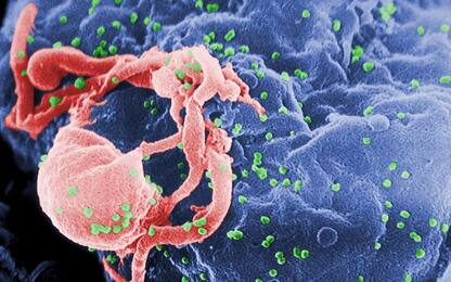 Aids, un anticorpo monoclonale può prevenire l’infezione nelle scimmie